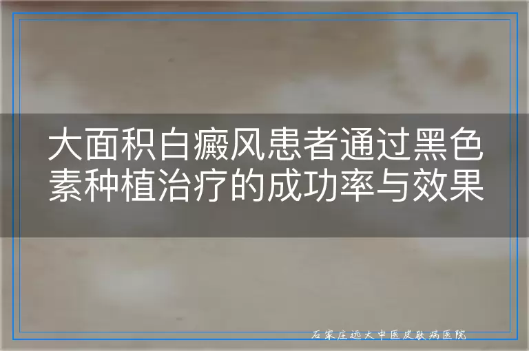 大面积白癜风患者通过黑色素种植治疗的成功率与效果观察