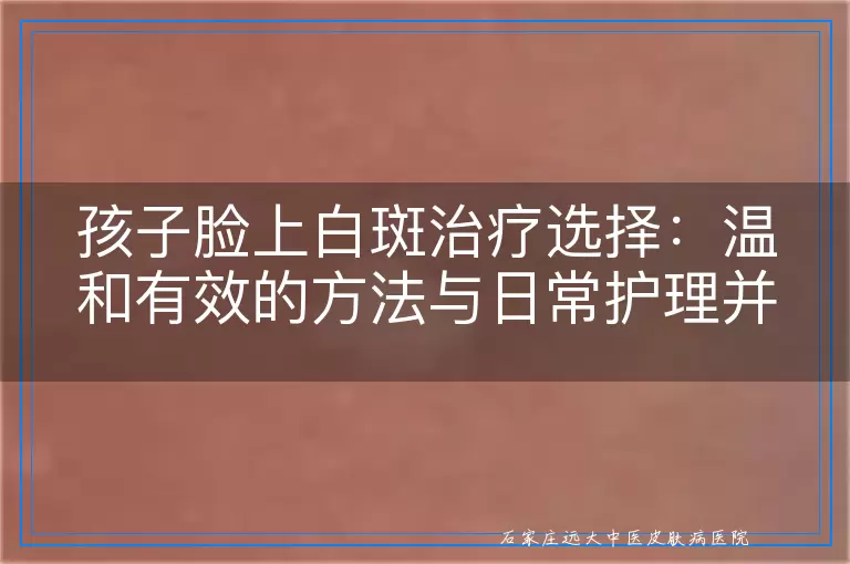 孩子脸上白斑治疗选择：温和有效的方法与日常护理并重