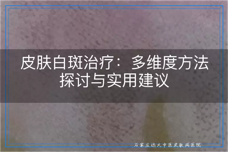 皮肤白斑治疗：多维度方法探讨与实用建议