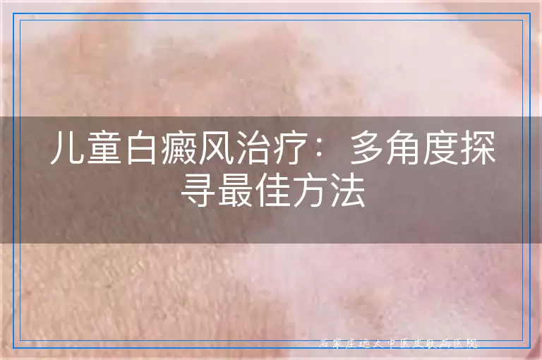 儿童白癜风治疗：多角度探寻最佳方法