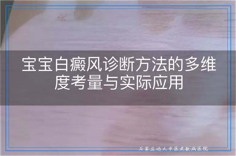 宝宝白癜风诊断方法的多维度考量与实际应用