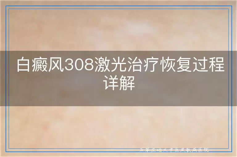 白癜风308激光治疗恢复过程详解
