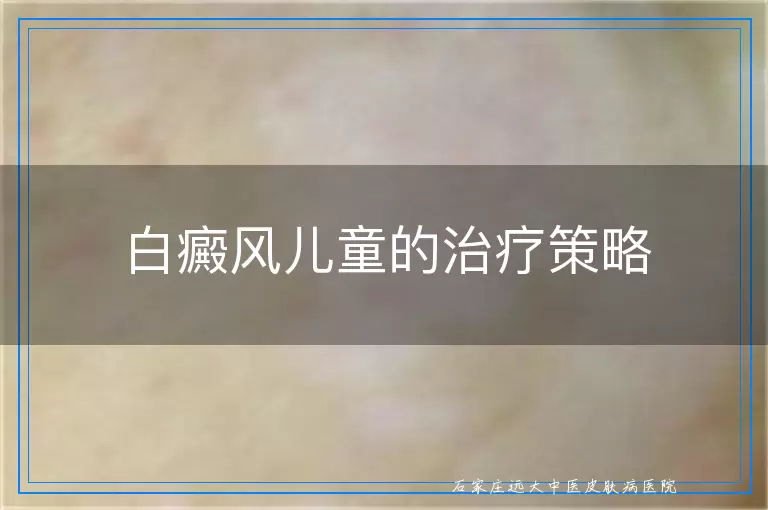 白癜风儿童的治疗策略