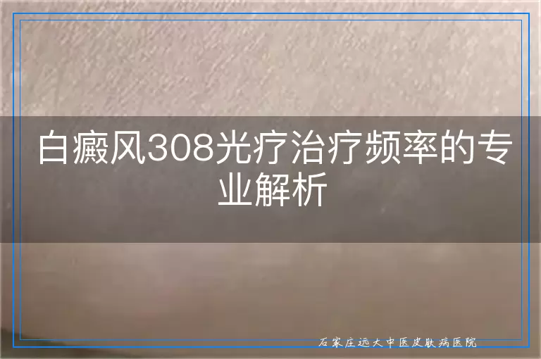 白癜风308光疗治疗频率的专业解析