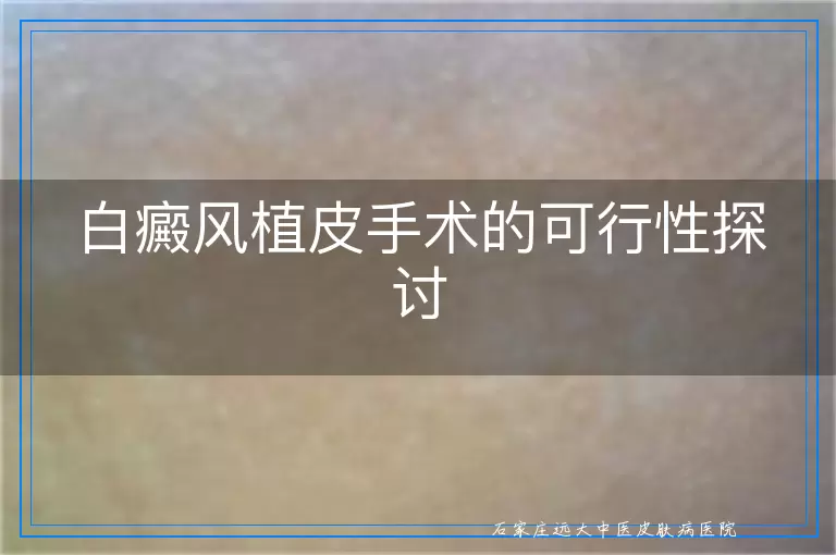 白癜风植皮手术的可行性探讨