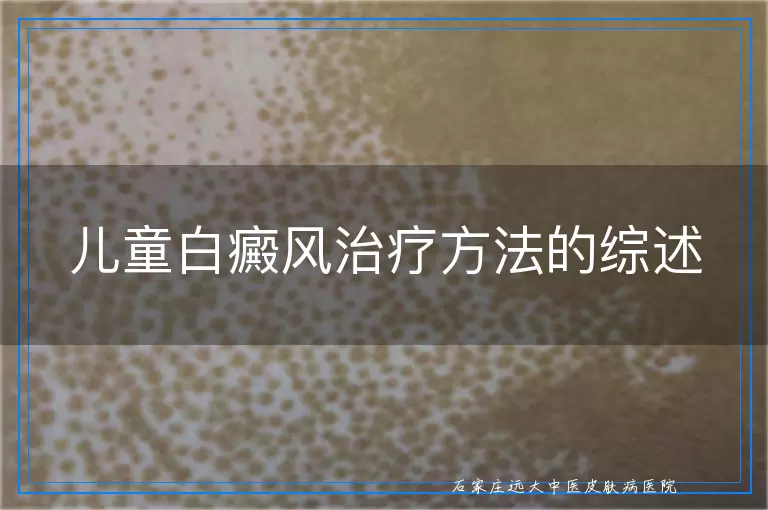 儿童白癜风治疗方法的综述