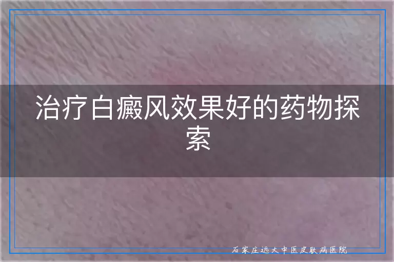 治疗白癜风效果好的药物探索