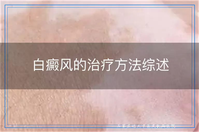 白癜风的治疗方法综述