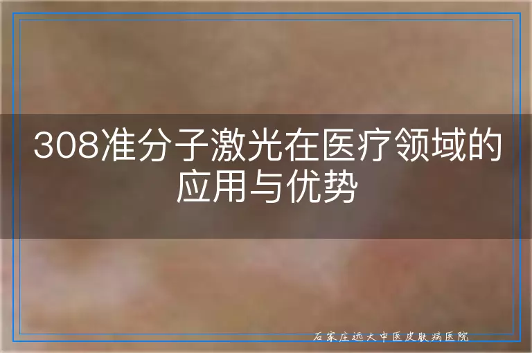 308准分子激光在医疗领域的应用与优势