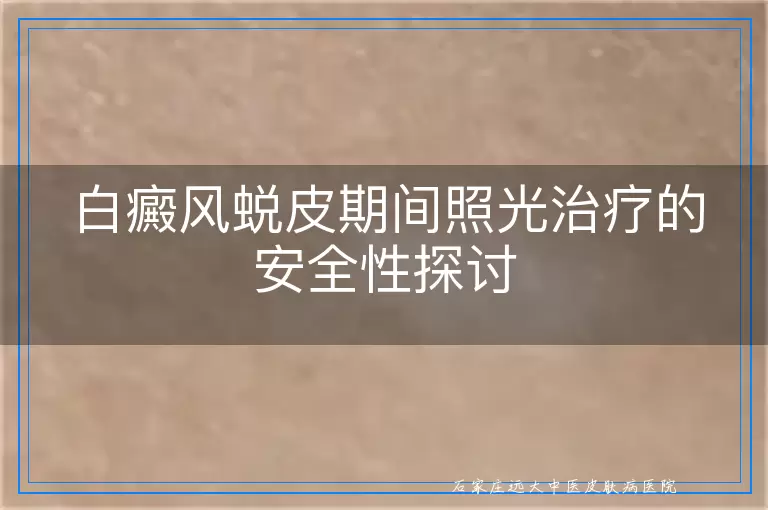 白癜风蜕皮期间照光治疗的安全性探讨