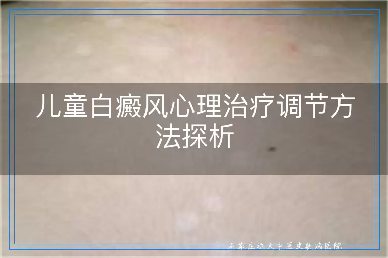 儿童白癜风心理治疗调节方法探析