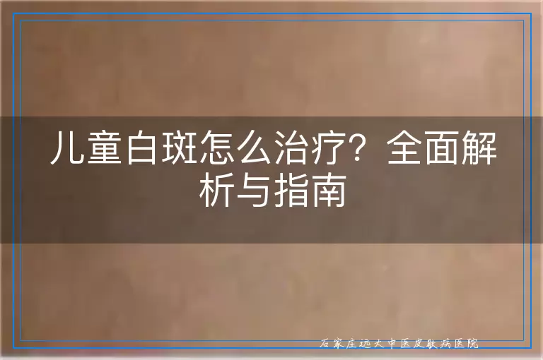 儿童白斑怎么治疗？全面解析与指南