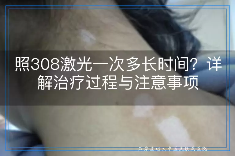 照308激光一次多长时间？详解治疗过程与注意事项