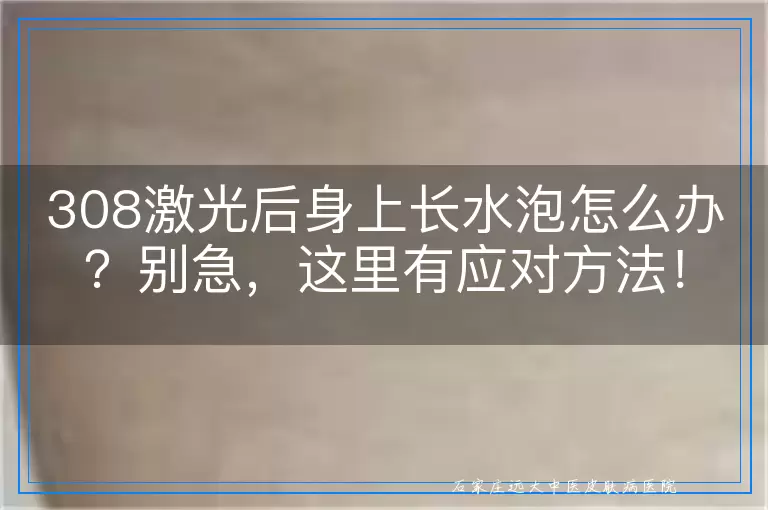 308激光后身上长水泡怎么办？别急，这里有应对方法！