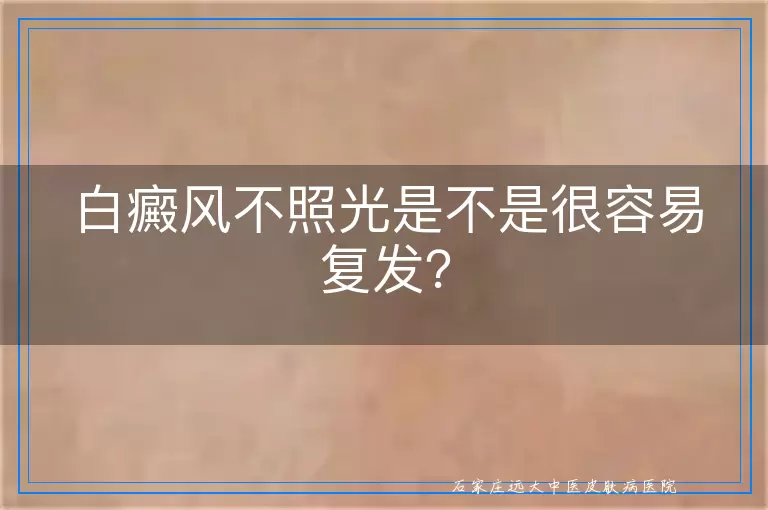 白癜风不照光是不是很容易复发？