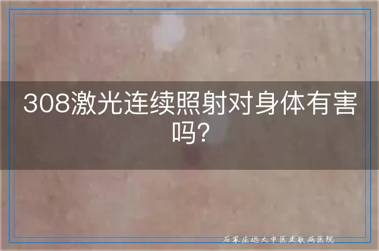 308激光连续照射对身体有害吗？