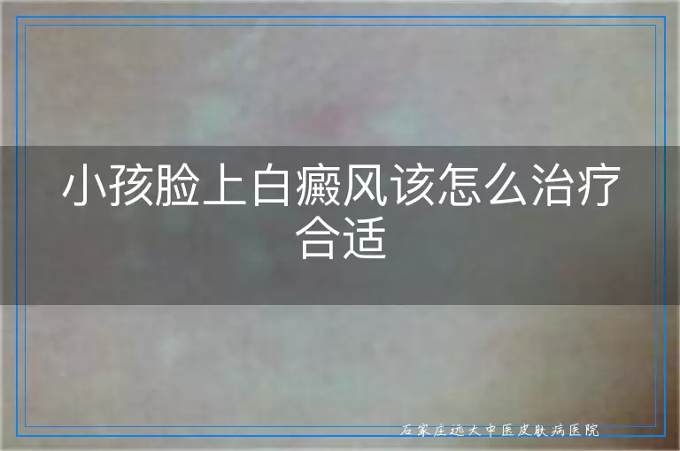 小孩脸上白癜风该怎么治疗合适