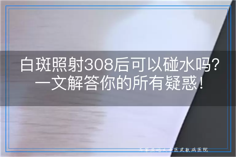 白斑照射308后可以碰水吗？一文解答你的所有疑惑！