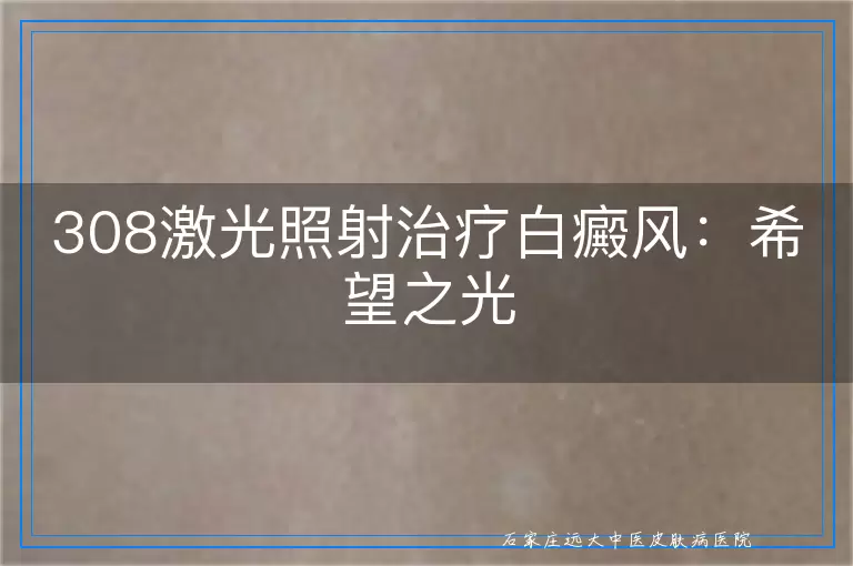 308激光照射治疗白癜风：希望之光