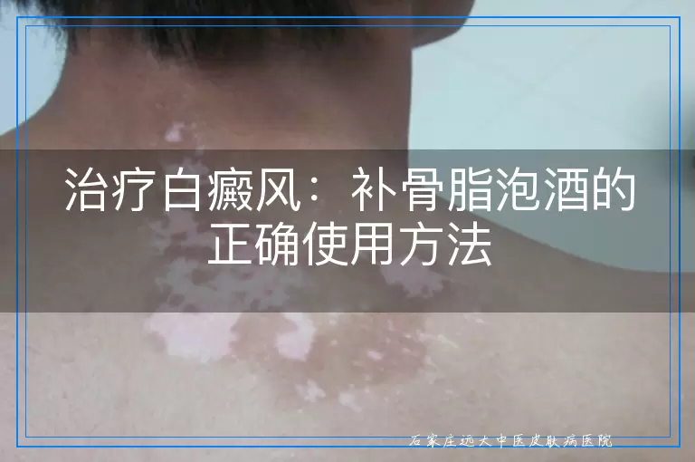 治疗白癜风：补骨脂泡酒的正确使用方法