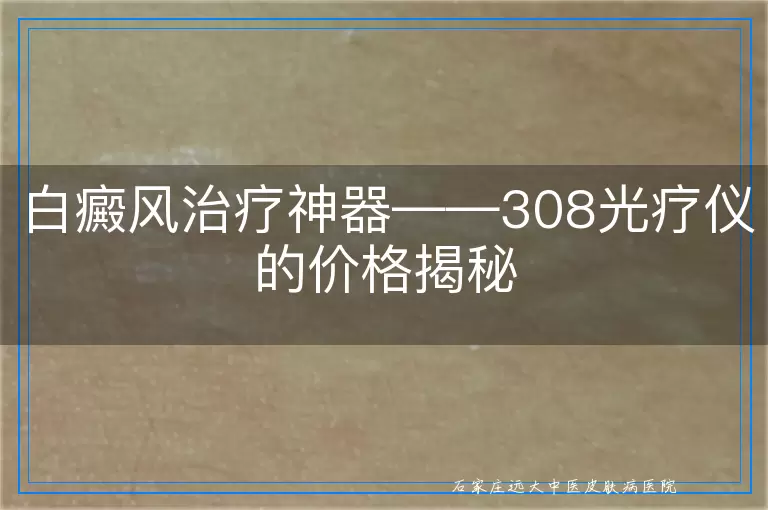 白癜风治疗神器——308光疗仪的价格揭秘