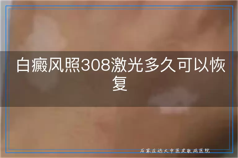 白癜风照308激光多久可以恢复