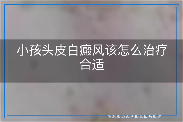 小孩头皮白癜风该怎么治疗合适