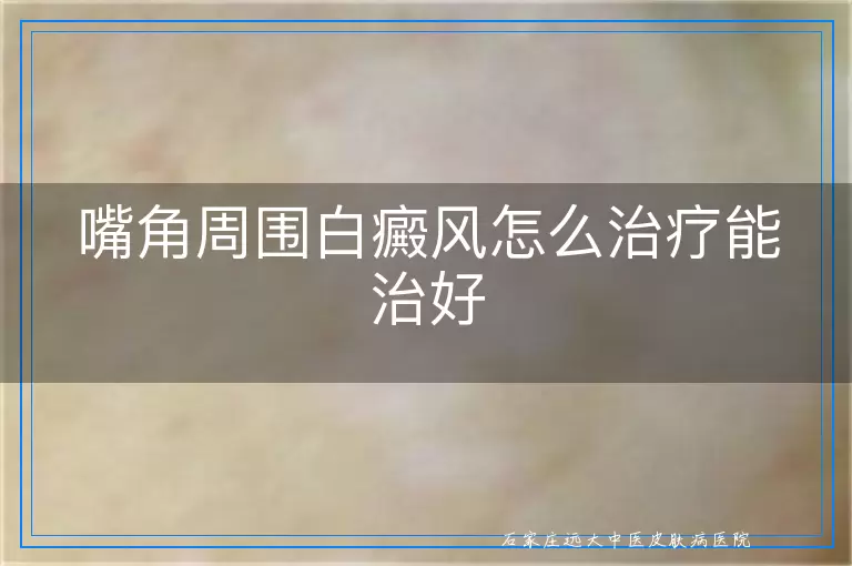嘴角周围白癜风怎么治疗能治好
