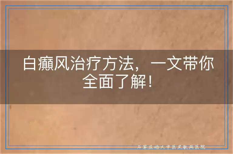 白癲风治疗方法，一文带你全面了解！