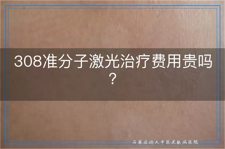 308准分子激光治疗费用贵吗？