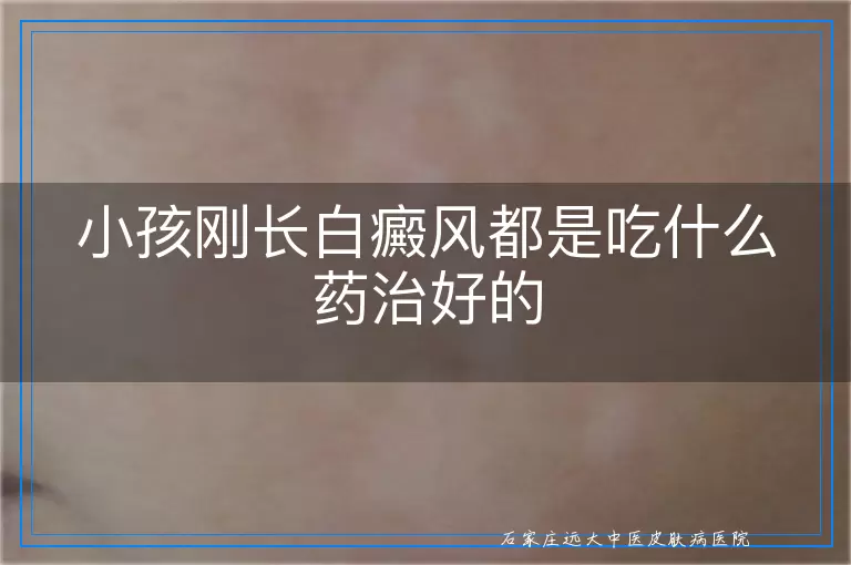 小孩刚长白癜风都是吃什么药治好的