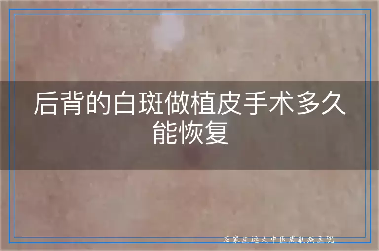 后背的白斑做植皮手术多久能恢复