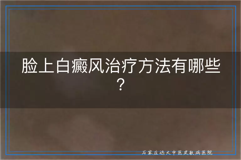 脸上白癜风治疗方法有哪些？