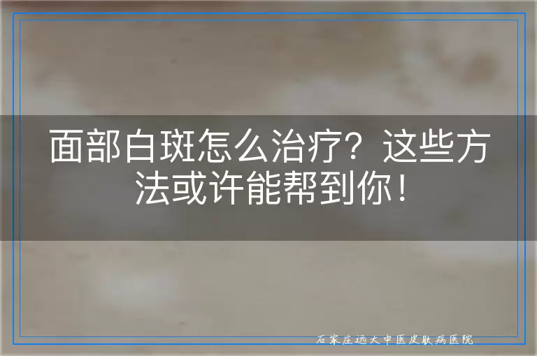 面部白斑怎么治疗？这些方法或许能帮到你！