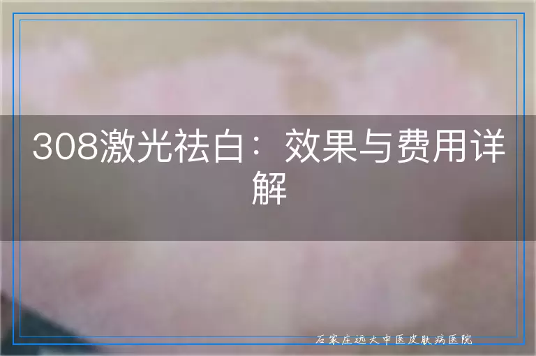 308激光祛白：效果与费用详解