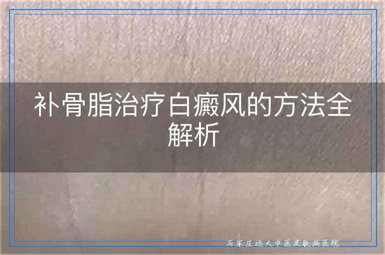 补骨脂治疗白癜风的方法全解析