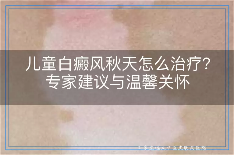 儿童白癜风秋天怎么治疗？专家建议与温馨关怀