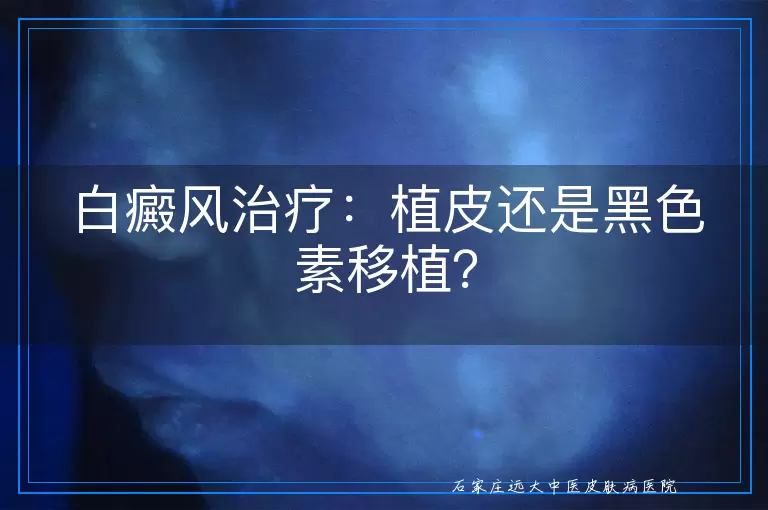 白癜风治疗：植皮还是黑色素移植？