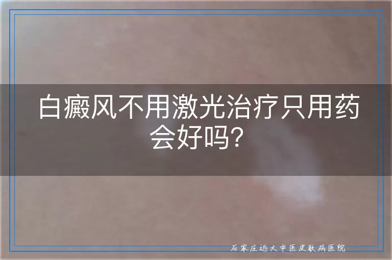 白癜风不用激光治疗只用药会好吗？