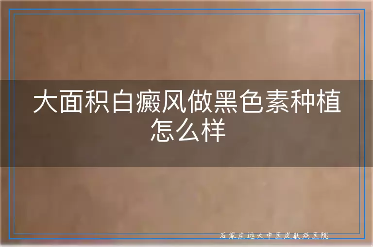 大面积白癜风做黑色素种植怎么样