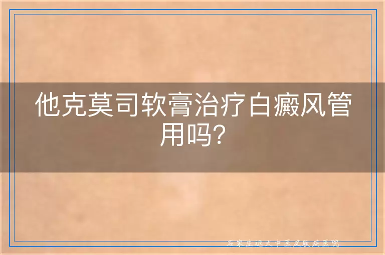 他克莫司软膏治疗白癜风管用吗？