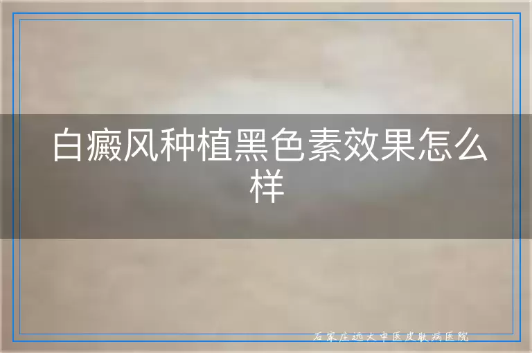 白癜风种植黑色素效果怎么样