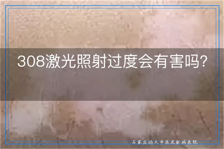 308激光照射过度会有害吗？