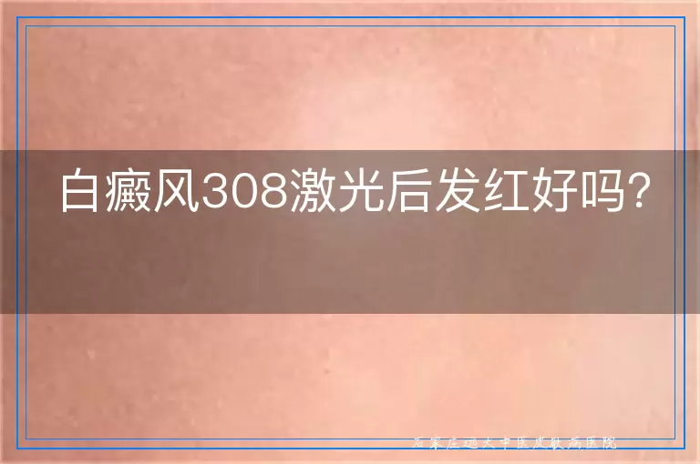 白癜风308激光后发红好吗？