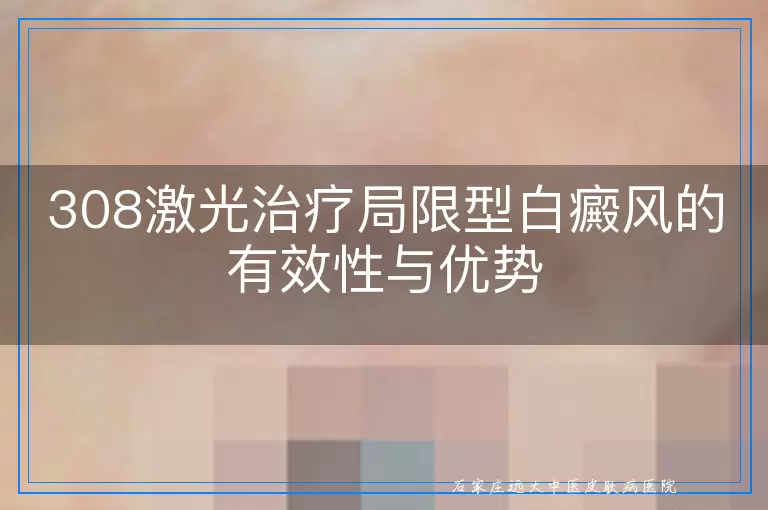 308激光治疗局限型白癜风的有效性与优势