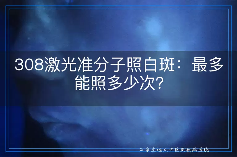308激光准分子照白斑：最多能照多少次？
