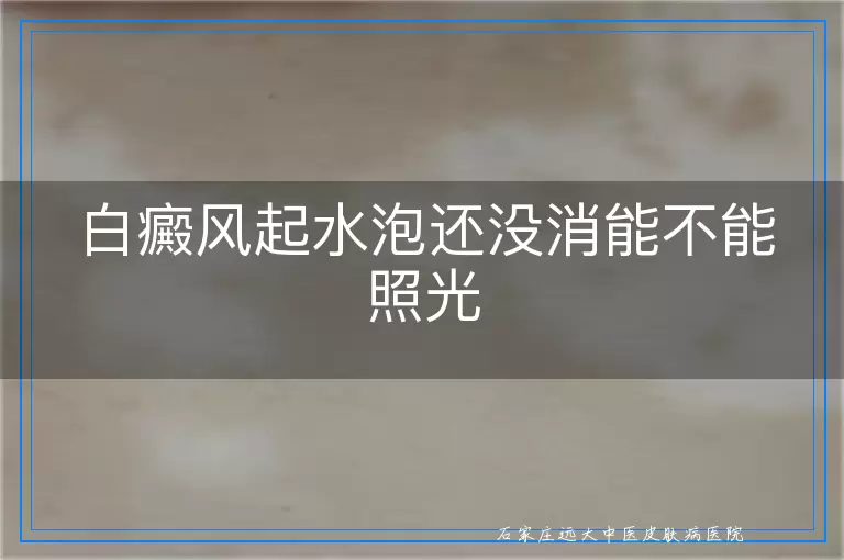 白癜风起水泡还没消能不能照光