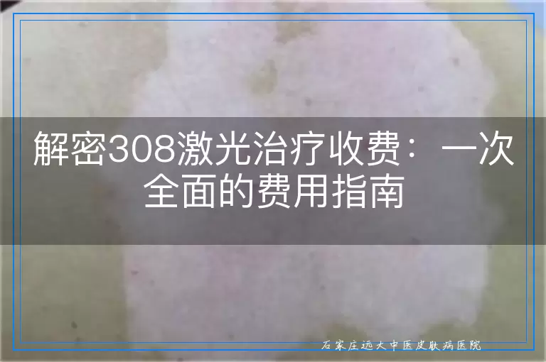 解密308激光治疗收费：一次全面的费用指南