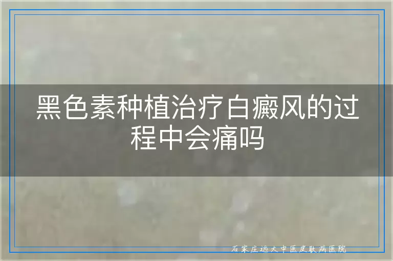 黑色素种植治疗白癜风的过程中会痛吗