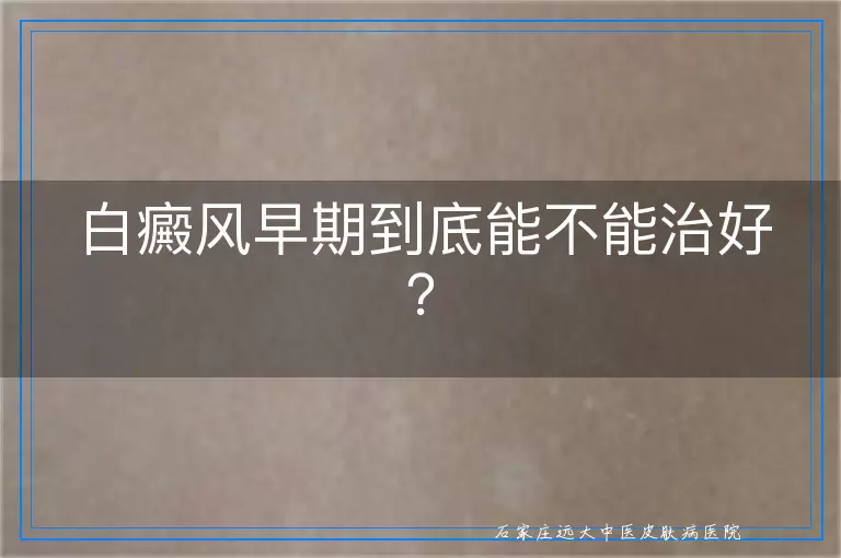 白癜风早期到底能不能治好？